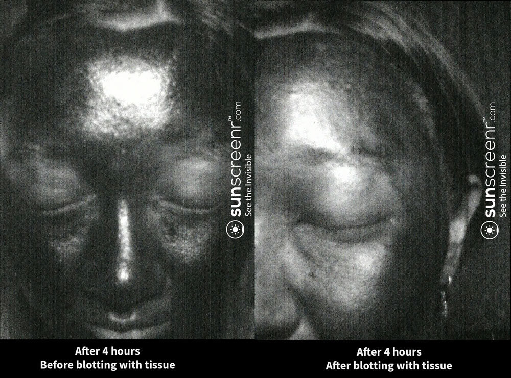 Before and After blotting with tissue